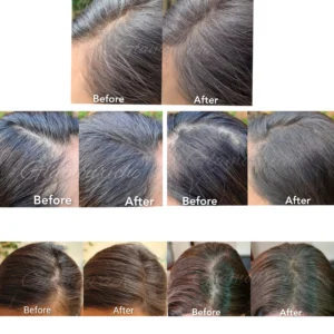 Hairline Filling Root Cover Up Powder Pic 4